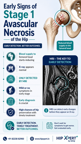 Early Signs of Stage 1 Avascular Necrosis of the Hip.png