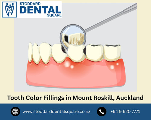 Tooth Color Fillings in Mount Roskill, Auckland.jpg