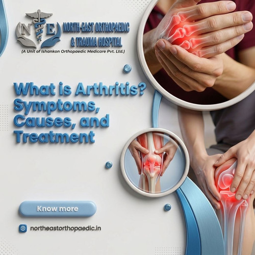 What is Arthritis? Symptoms, Causes, and Treatment.jpg