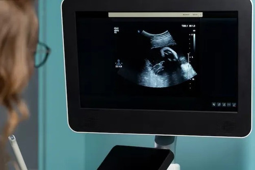 Color Doppler in Indore.jpg