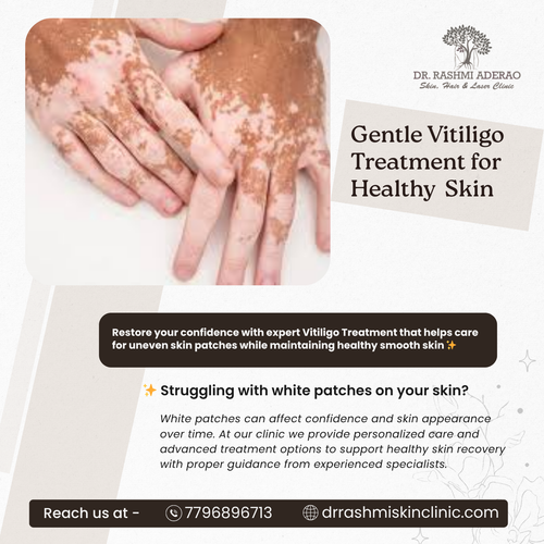 Regular follow up may help improve skin appearance and confidence gradually..png