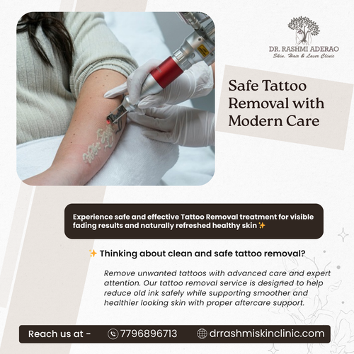 Tattoo Removal treatment with modern technology and careful skin care support..png
