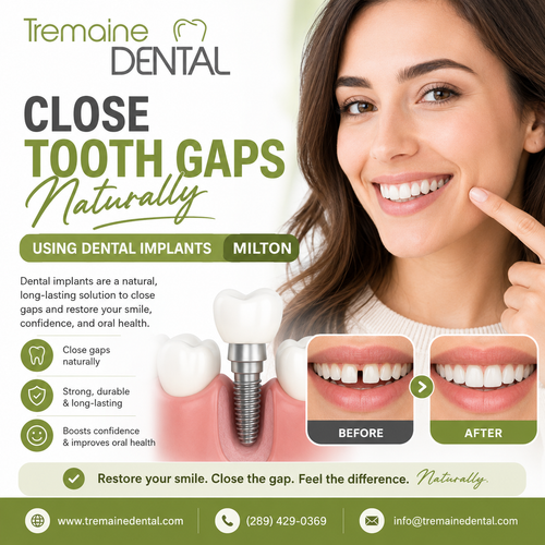 Close Tooth Gaps Naturally Using Dental Implants Milton.png