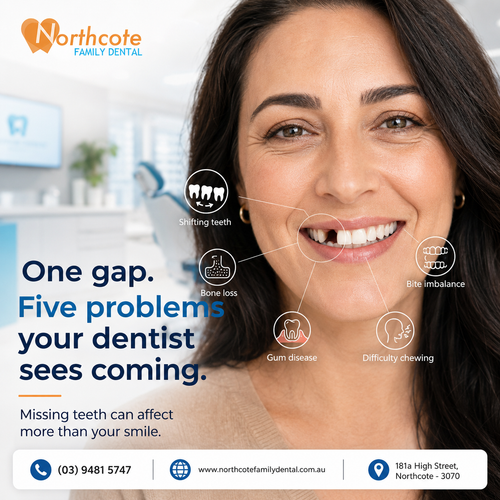 One gap. Five problems your dentist sees coming..png