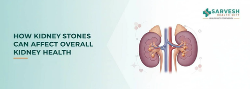 how kidney stones can affect overall kidney health.png