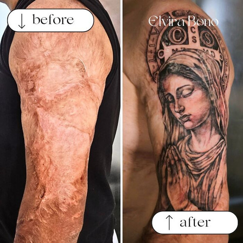 6a4f55cd51868 tattoo on burn scar by accident suffered in childhood 700.jpg