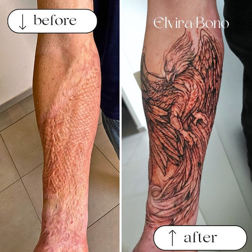 6a4f568aacbb9 before after scar cover up tattoos elvira bono 700.jpg
