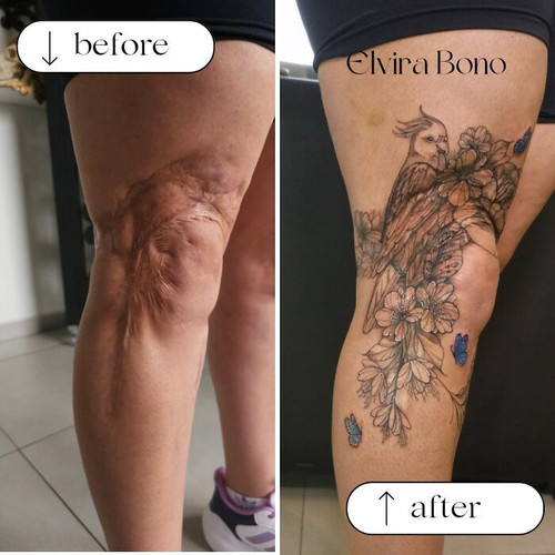 6a4f55dab9c71 extensive scar tattoo due to traffic accident 700.jpg