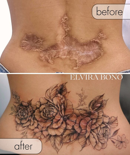 6a4f582684eae before after scar cover up tattoos elvira bono 700.jpg