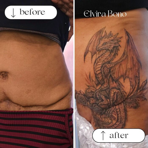 6a4f56ef1f5ee before after scar cover up tattoos elvira bono 700.jpg