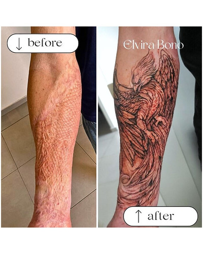 6a4f568aacbb9 before after scar cover up tattoos elvira bono 700 bordered.jpg