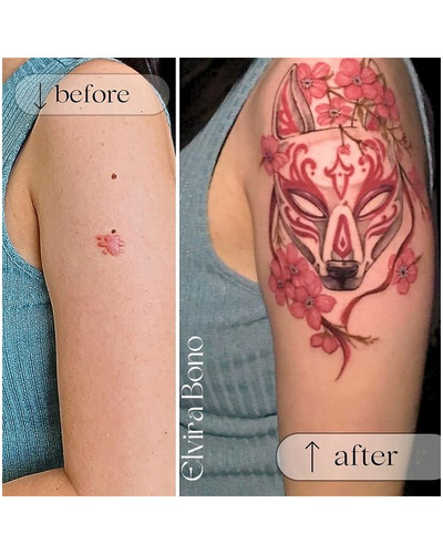 6a4f58fb136f3 before after scar cover up tattoos elvira bono 700 bordered.jpg