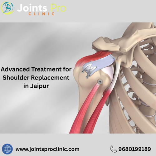 Advanced Treatment for Shoulder Replacement in Jaipur.jpg