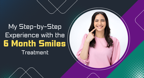 My Step by Step Experience with the 6 Month Smiles Treatment.png