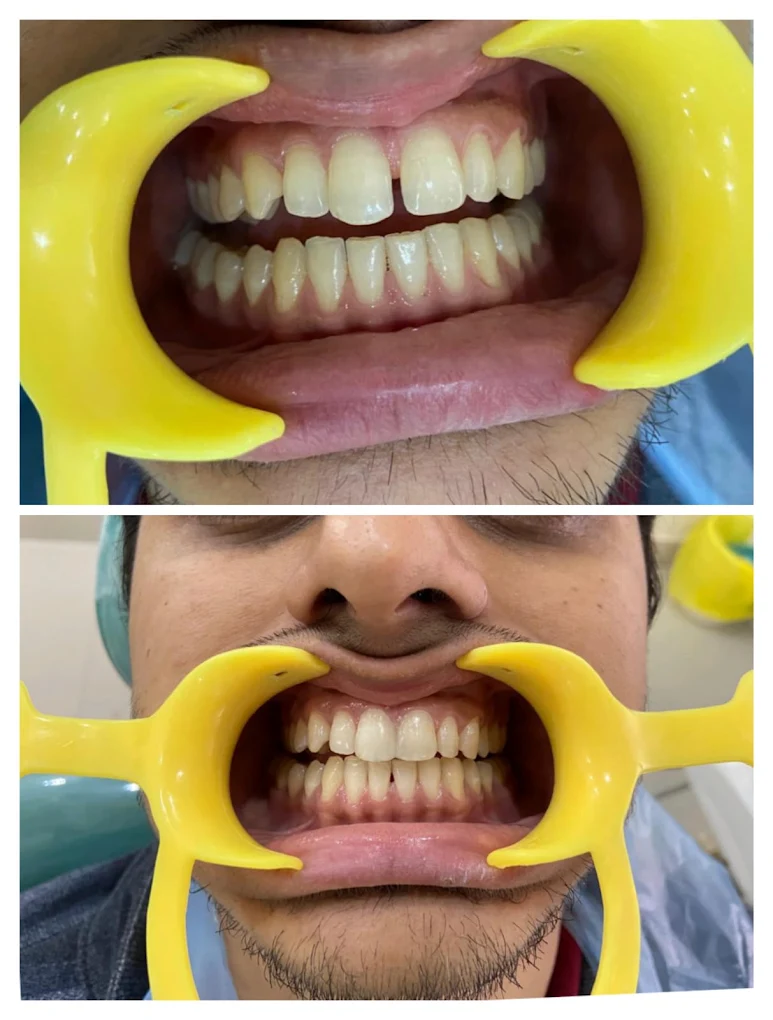 Arkas Dental Studio Gallery Image 16