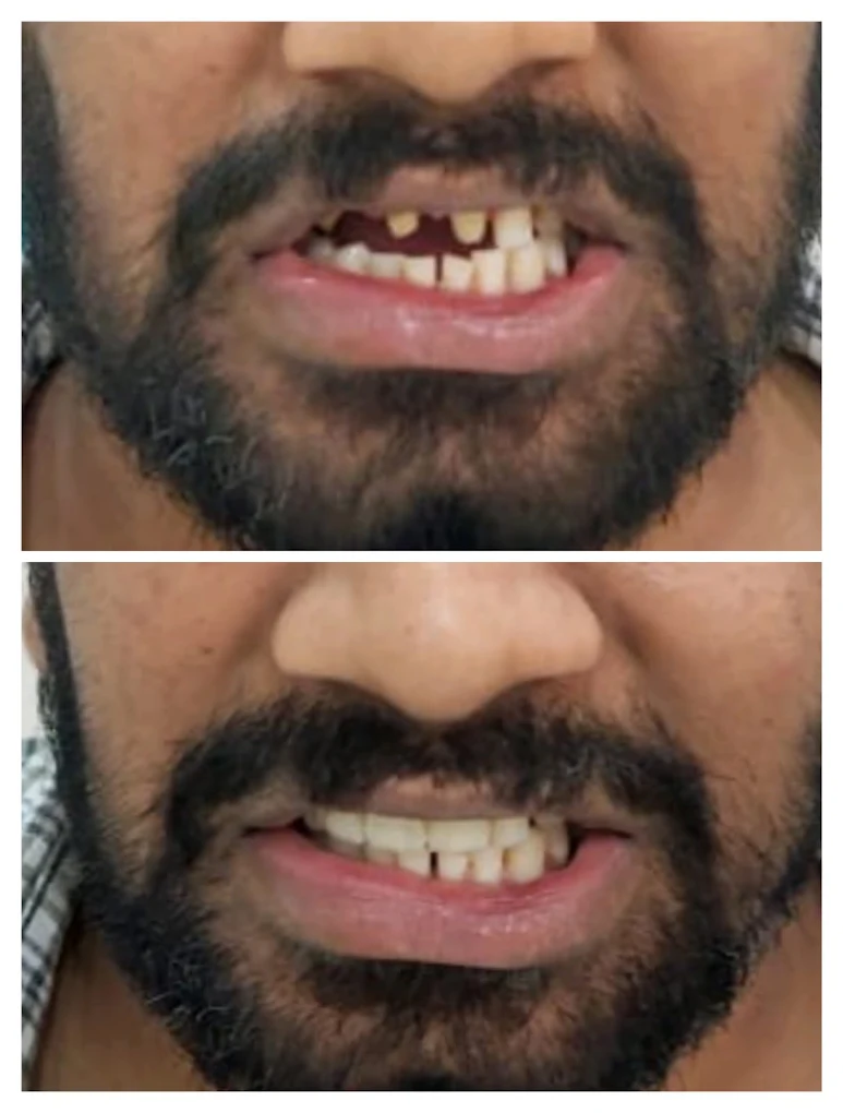 Arkas Dental Studio Gallery Image 8