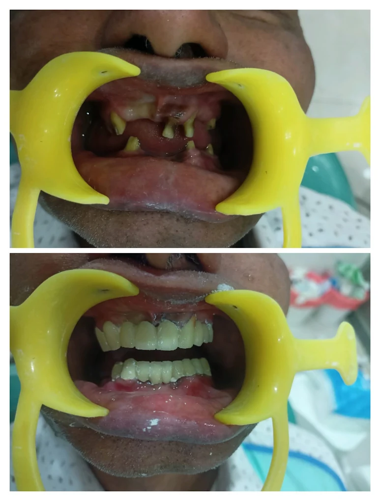 Arkas Dental Studio Gallery Image 10