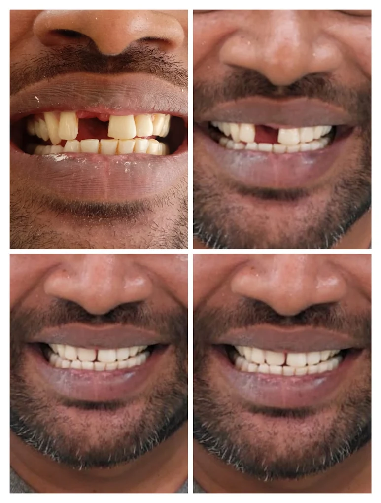 Arkas Dental Studio Gallery Image 6
