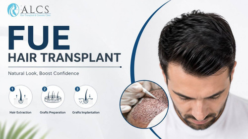 Best Fue Hair Transplant Clinic  in Jaipur | ALCS.jpg