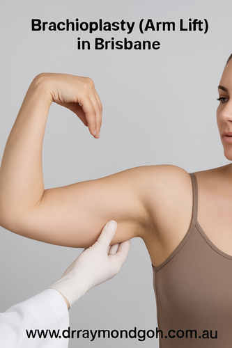 Brachioplasty (Arm Lift) in Brisbane.png