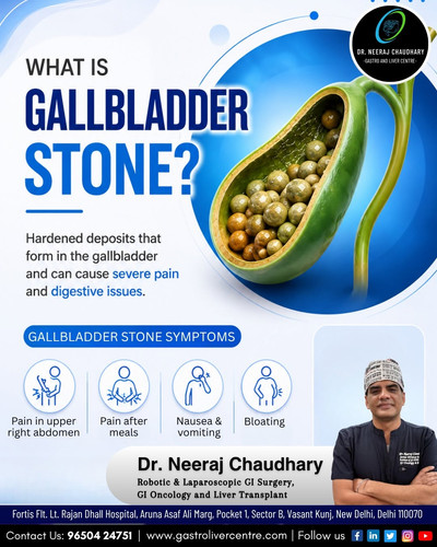 Best Gallbladder Surgeon in Vasant Kunj.jpg