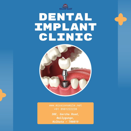 Advanced Dental Implant Surgery in Kolkata with Expert Dental Care.jpg