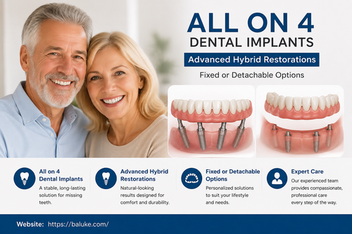 All on 4 Dental Implants.png