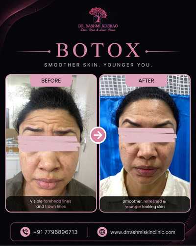 A smooth and refreshed look can boost your confidence..png