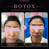 A smooth and refreshed look can boost your confidence.