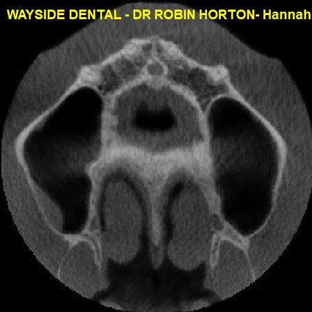 Hannah Pichon G VXIMAGES 126909 12690900.jpg