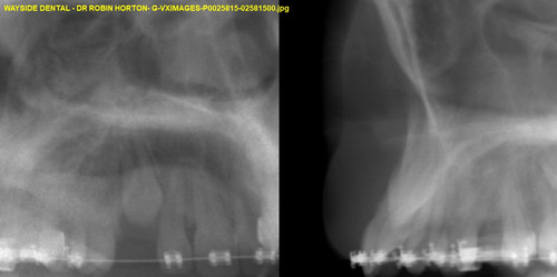 G VXIMAGES P0025815 02581500.jpg