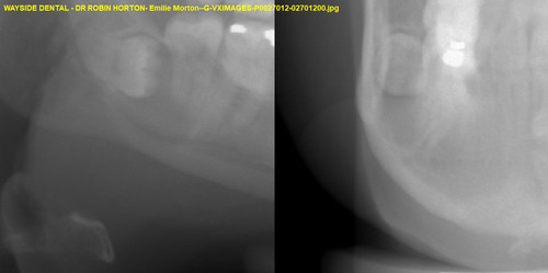 Emilie Morton G VXIMAGES P0027012 02701200.jpg