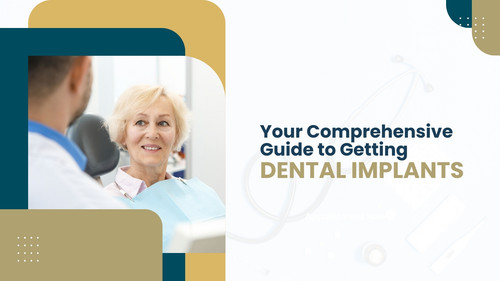 Your Comprehensive Guide to Getting Dental Implants in London.jpg