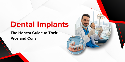 Dental Implants The Honest Guide to Their Pros and Cons Copy.png