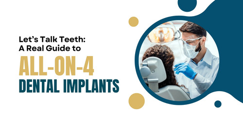 Let’s Talk Teeth A Real Guide to All on 4 Dental Implants in the UK Copy.jpg