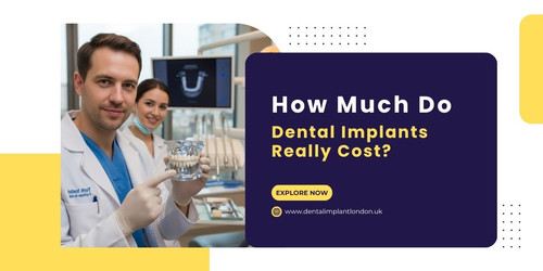 How Much Do Dental Implants Really Cost A Realistic Price Guide Copy.jpg