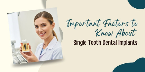 Important Factors to Know About Single Tooth Dental Implants Copy.jpg
