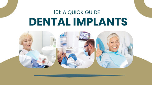 Dental Implants 101 A Quick Guide.jpg