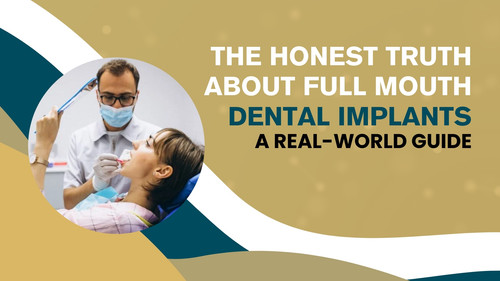 The Honest Truth About Full Mouth Dental Implants A Real World Guide Copy.jpg