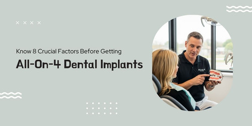 Know 8 Crucial Factors Before Getting All On 4 Dental Implants Copy.jpg