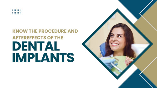 Know the Procedure and Aftereffects of the Dental Implants.jpg