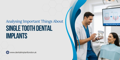Analysing Important Things About Single Tooth Dental Implants.jpg