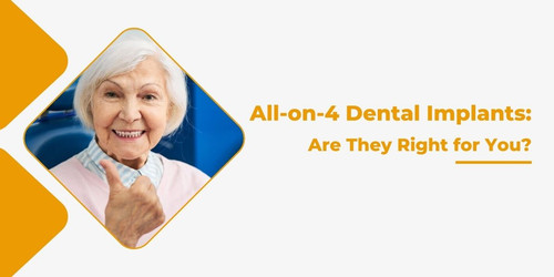 All on 4 Dental Implants Are They Right for You.jpg
