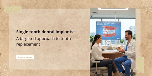 Single tooth dental implants a targeted approach to tooth replacement.jpg