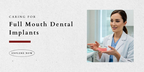 Caring for Full Mouth Dental Implants Your Ultimate Guide Copy.jpg