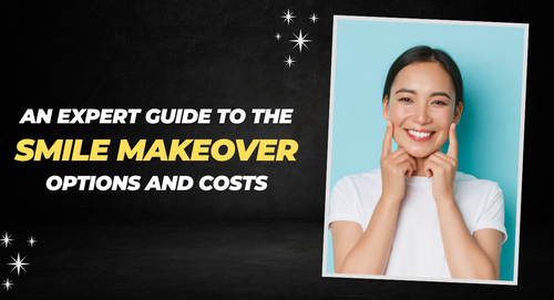 An Expert Guide to the Smile Makeover Options and Costs.png