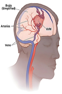 sidharthvascular.com.jpg