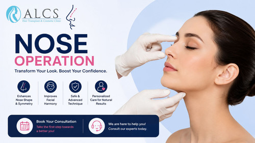 Nose Operation Price – What You Should Know Before Surgery.jpg