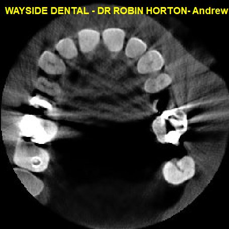 Andrew Wilson G VXIMAGES 1120908 01881300.jpg