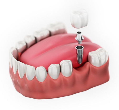 Orthodontics Silver Spring.jpg